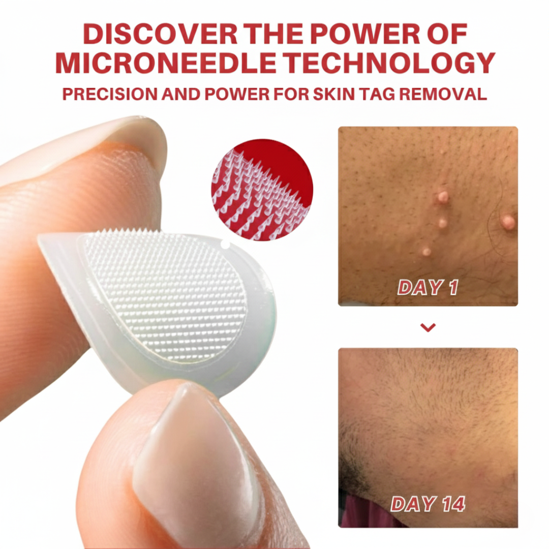 Cvreoz® MicroNeedle Botanic Skin Tag Removal Patch